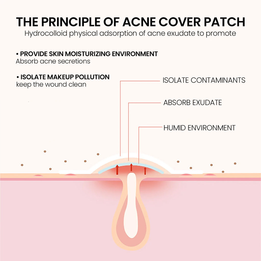 JAYSUING Facial Acne Patch Improve Inflammation Remove Acne Cleanning Dirt Shrink Pores Relieve Discomfort Facial Soothing Patch Oasis Select