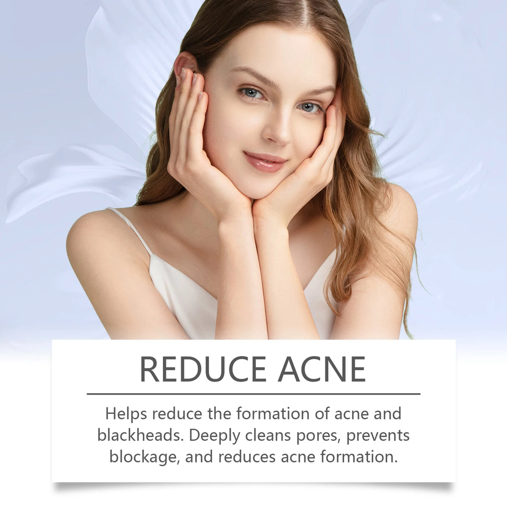 20/40/60g Anti Acne Cream Oil Control Repair Pimple Spot Remove Acne Mark Cleaning Refreshing Moisturizer Skin Pore Shrink Cream Oasis Select