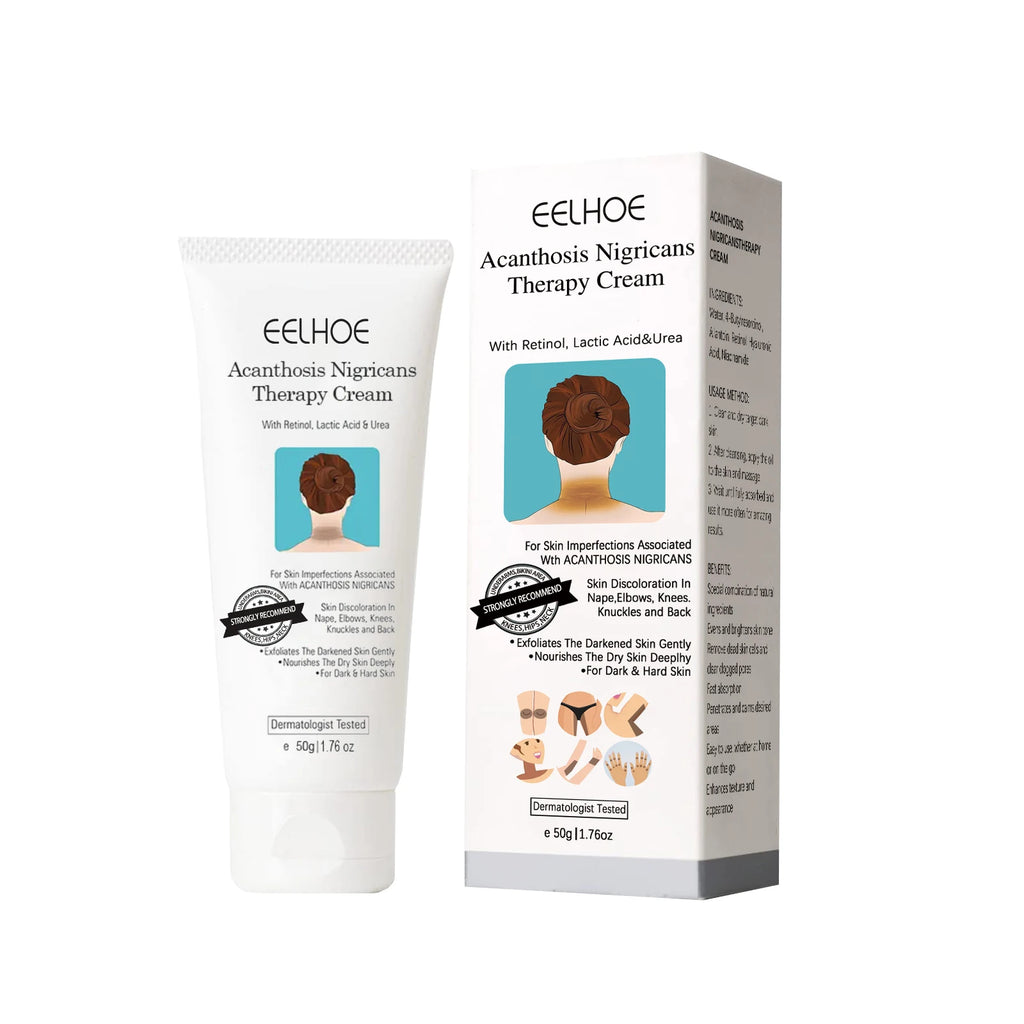 EELHOE Whitening Cream Brightening Skin For Dark Skin Neck Arm Knee Joint Underarm Body Care Acanthosis Nigricans Therapy Cream Oasis Select 50g