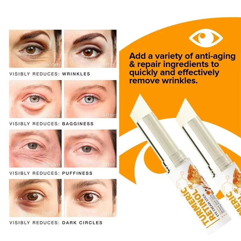 SADOER Retinol Eye Cream – Brighten, Firm & Hydrate Eye Cream Oasis Select