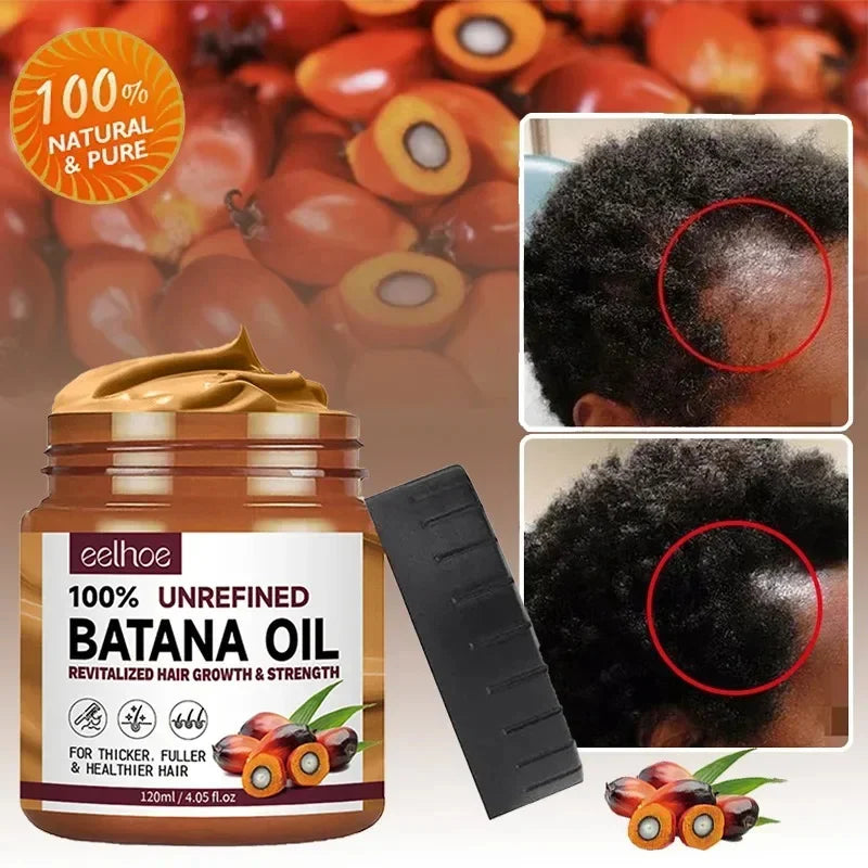 Batana Hair Growth Oil Conditioner Anti Hair Loss Products Fast Growing Hair Mask Nourishing Repair Roots Hair Care for women Oasis Select