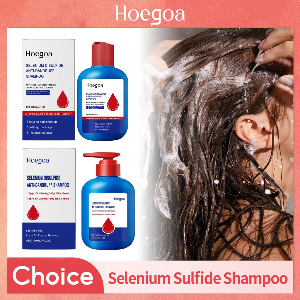 Selenium Sulfide Shampoo Deep Cleansing Remove Dandruff Reduce Scalp Itchy Balance Oil Strengthen Hair Roots Fluffy Hair Shampoo Oasis Select
