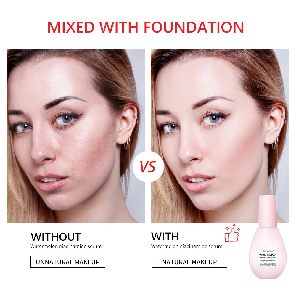 New Watermelon nicotinamide Light Bulb Essence Moisturizing Skin Brightening Face Brightening Essence For Women Skin Care Oasis Select
