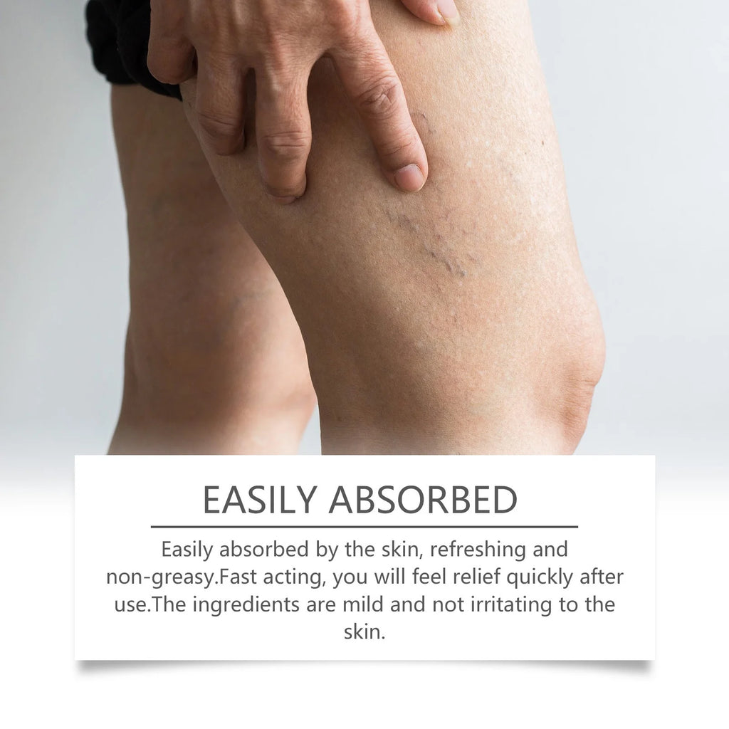 OceAura Varicose Veins Relief Cream – Spider Veins & Leg Pain Varicose Vein Cream Oasis Select