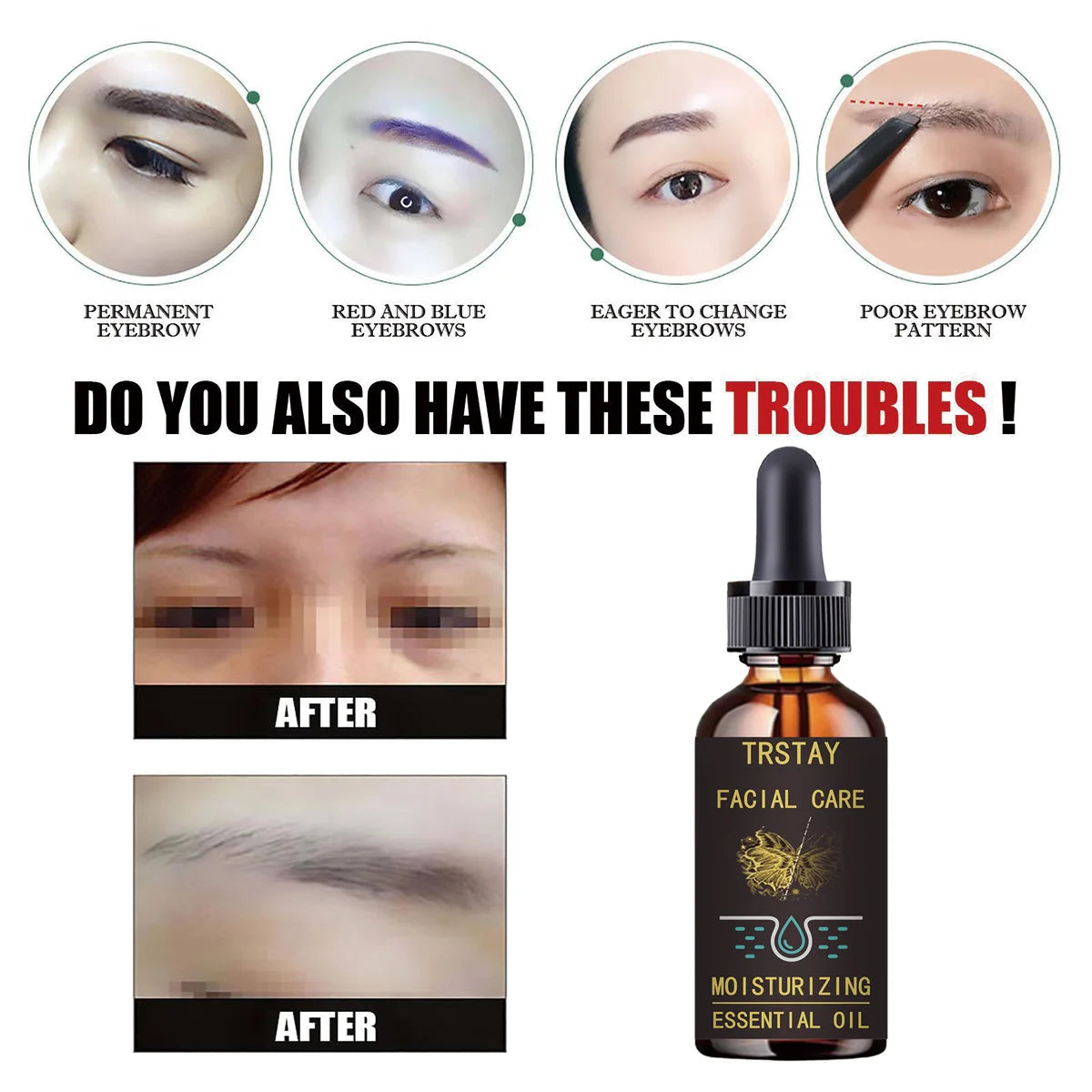 TRSTAY Natural Skin Brightening Oil – Dark Spot & Tone Corrector