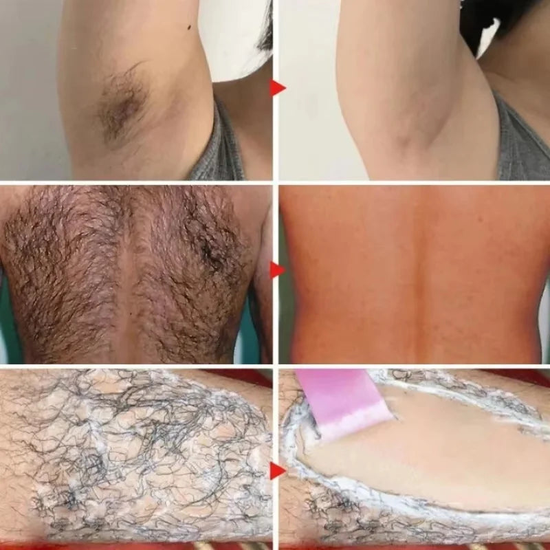 SADOER Hair Removal Cream & Growth Inhibitor – Body & Face Hair Removal Cream Oasis Select