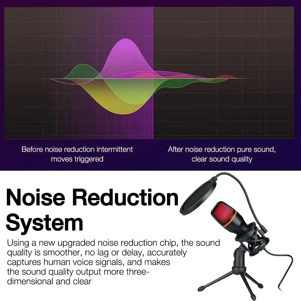 AyeBeau USB Condenser Microphone RGB Kit – Gaming & Podcast