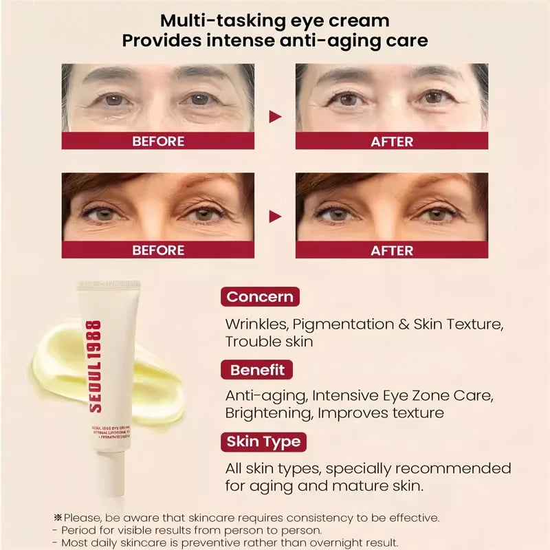 SEOUL 1988 4% Retinol Eye Cream – Firming & Brightening 30ml