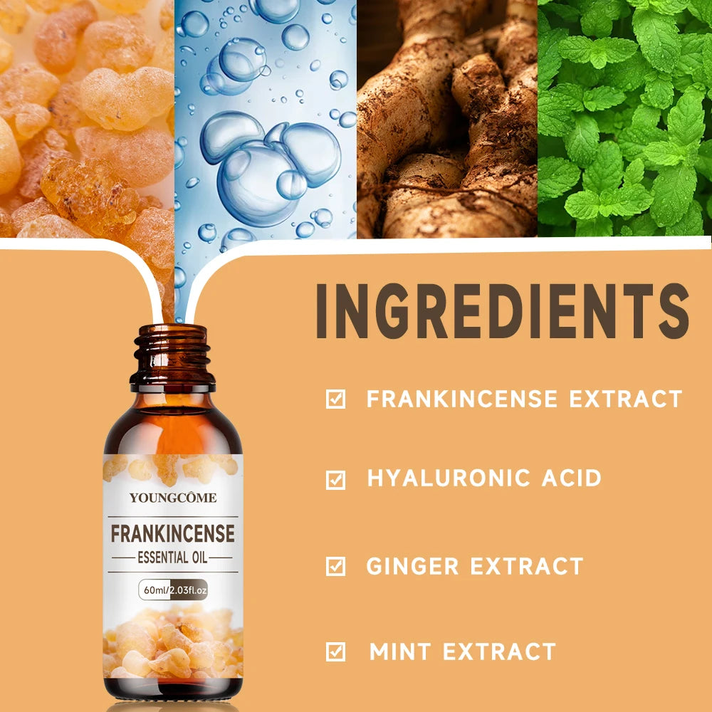 Frankincense Gum Essential Oil – Face, Body, Hair & Diffusion Essential Oil Oasis Select