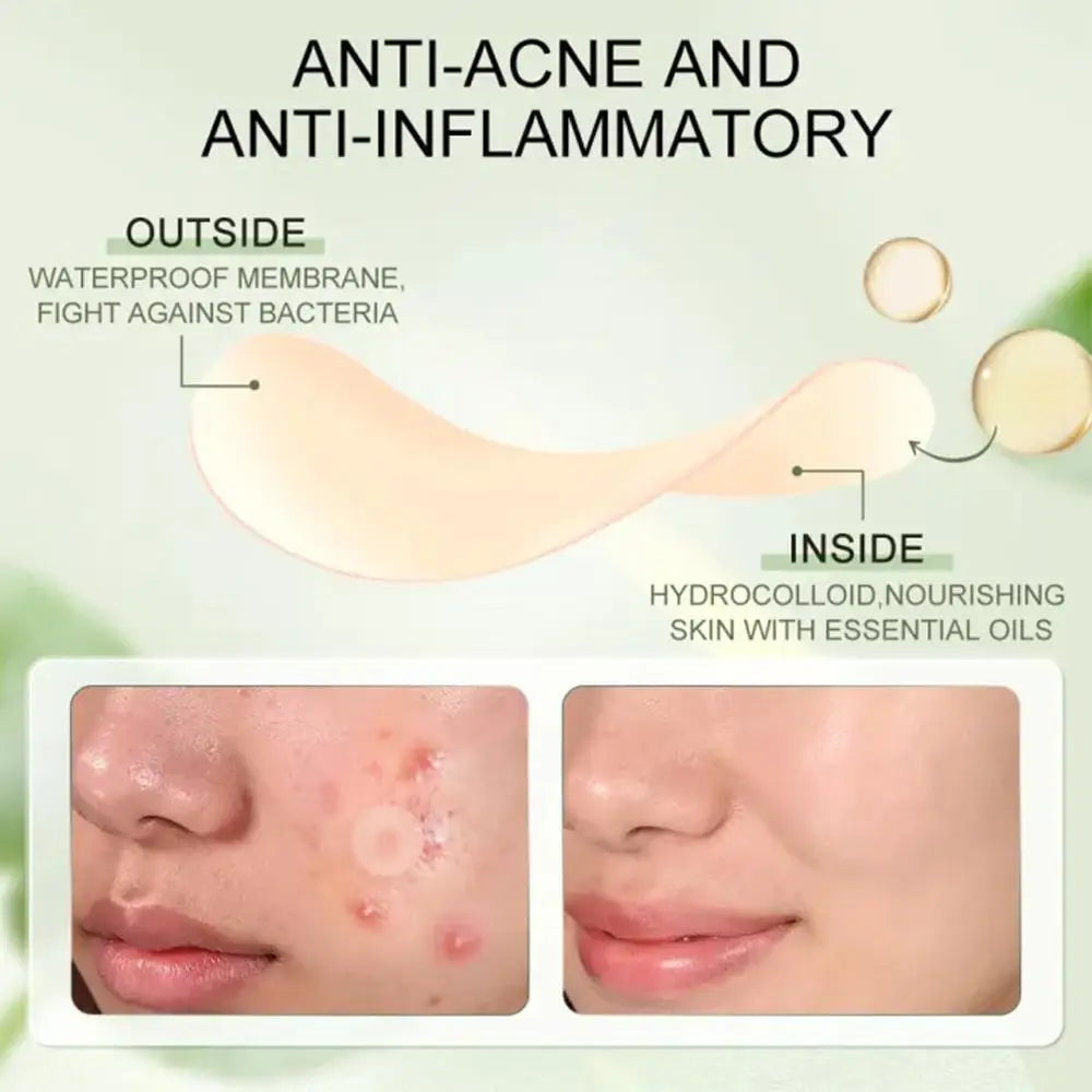 30pcs/BOX Hydrocolloid Salicylic Acne Pimple Patch Fade Repair Acne Invisible Removal Pimple Anti Spots Marks Conceale Oasis Select
