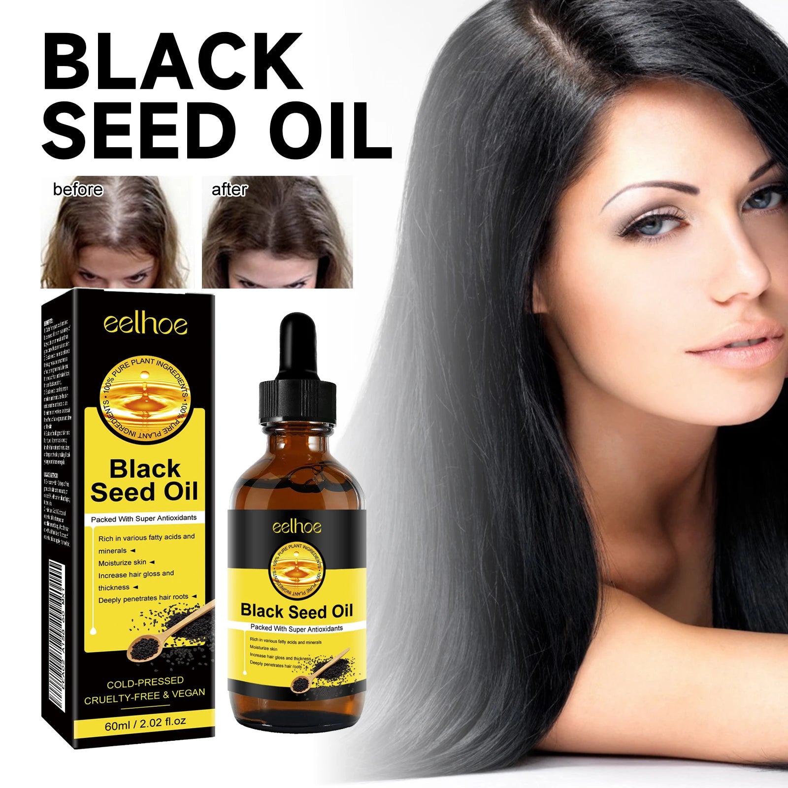 Eelhoe Hair Growth Essential Oil – Thinning & Baldness