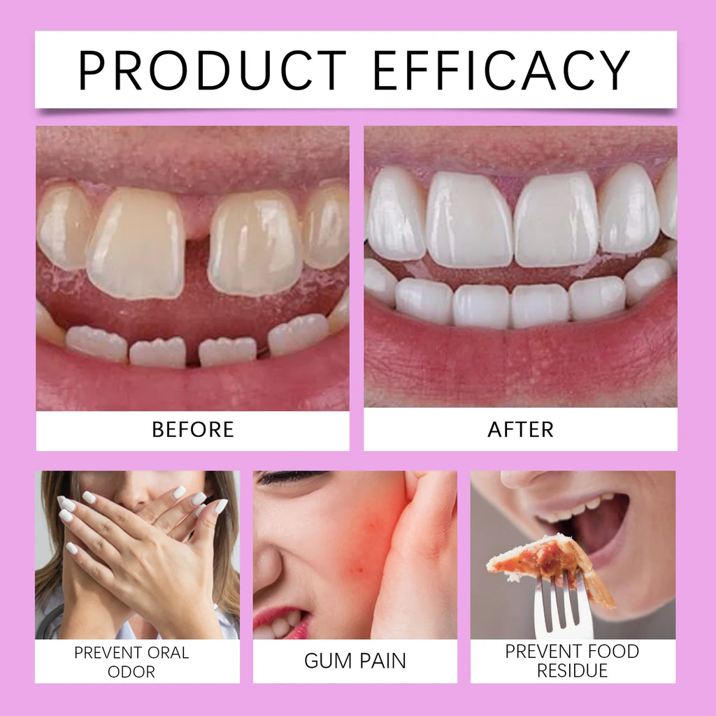 Oralhoe Strong Denture Adhesive Cream – 20g False Teeth Glue Denture Adhesive Cream Oasis Select