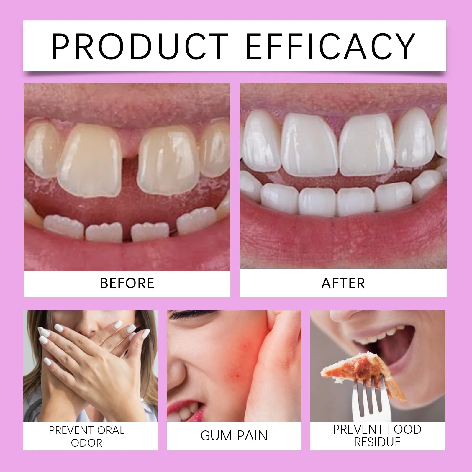 Oralhoe Strong Denture Adhesive Cream – 20g False Teeth Glue Denture Adhesive Cream Oasis Select
