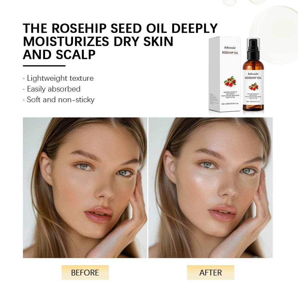 Organic Rosehip Oil Rose Hips Face Oils 30ml Fast-Absorbing Skin Care Moisturizer Face Oil Organic Rosehip Seed Oil Essence Oasis Select