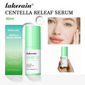 Centella Asian Facial Serum Centella Soothing Moisturizing Repair Skin Lotion Essence Korean Skin Care Facial Products For Women Oasis Select 60ml