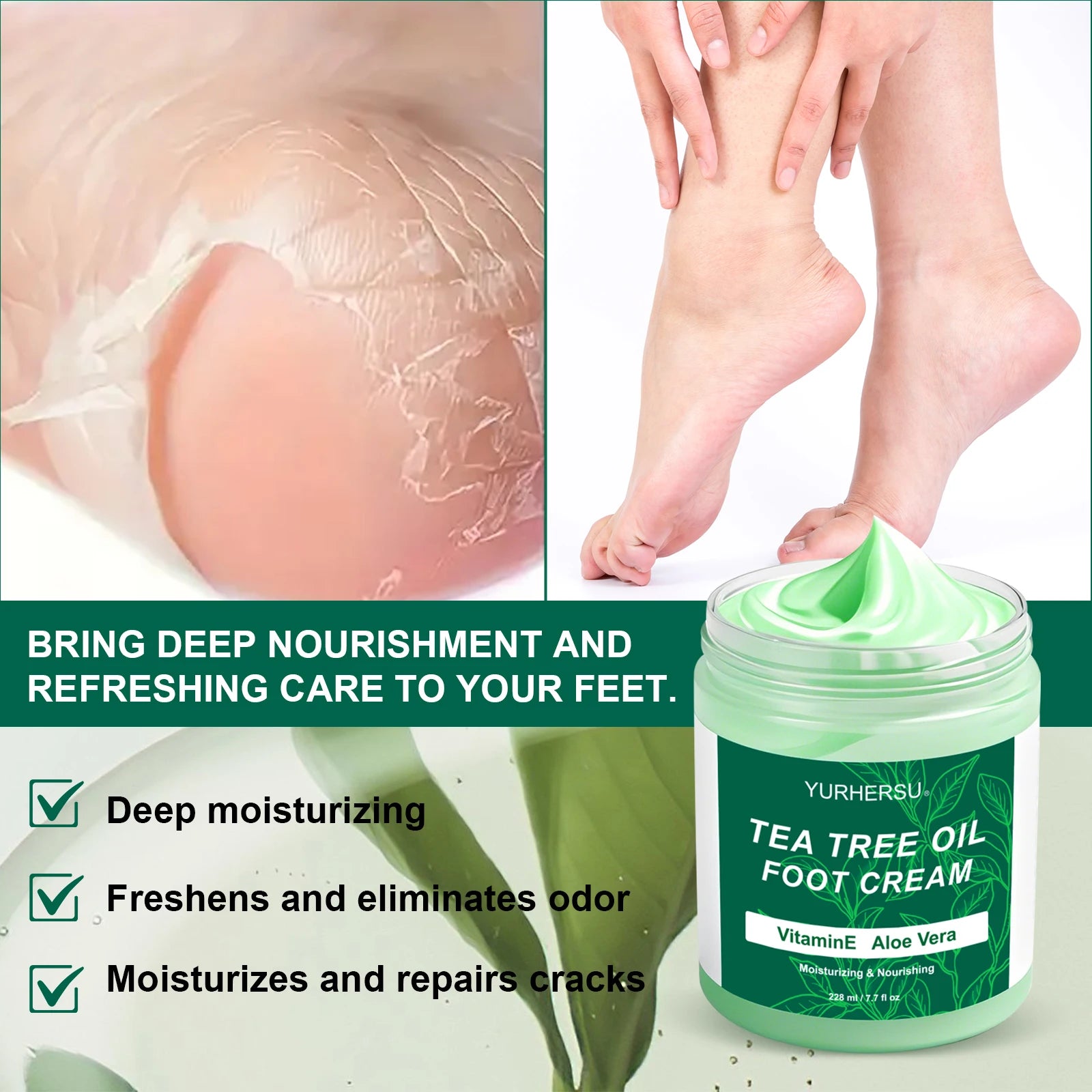 YURHERSU Foot Cream – Moisturizer & Dead Skin Remover 228ml Foot Moisturizing Cream Oasis Select