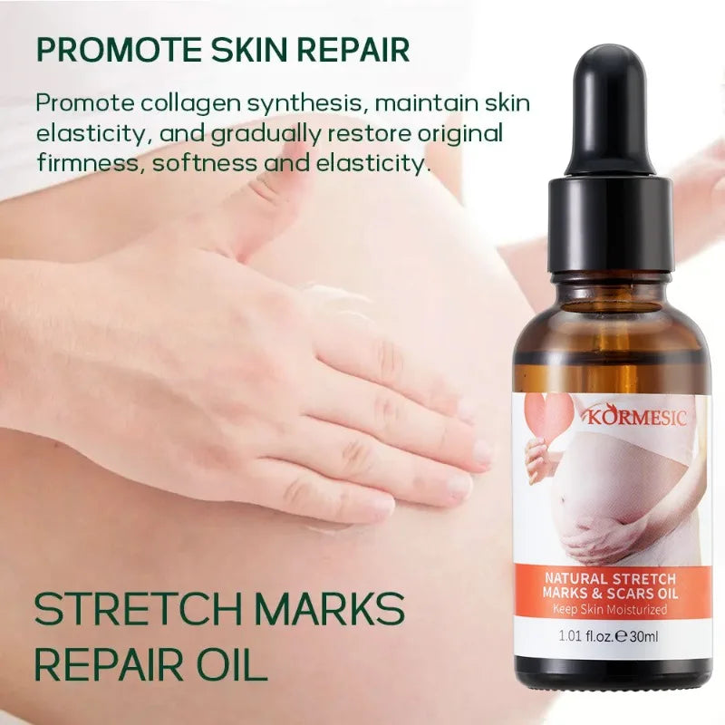 BIOAOUA Stretch Mark Oil Serum – Improve Skin Elasticity