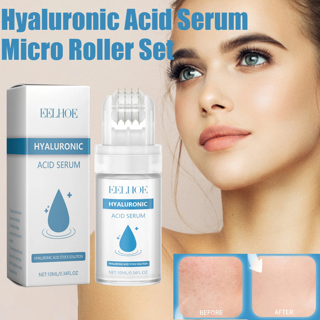 Eelhoe Hyaluronic Acid Micro Roller Serum 0.25mm – 64 Pins Microneedle Face Serum Oasis Select