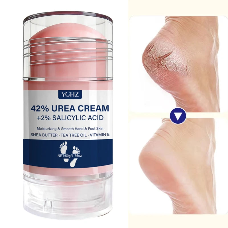 42% Urea & 2% Salicylic Acid Foot & Hand Cream Stick 50g