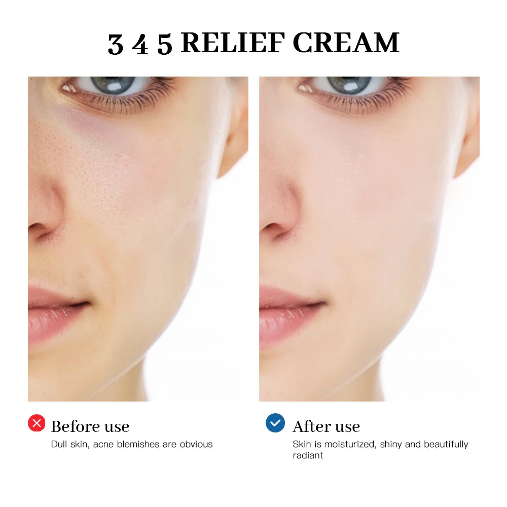 345 Relief Cream Comprehensive solution to skin problems Anti-sugar and antioxidant Brightening skin Improving acne marks Moistu Oasis Select