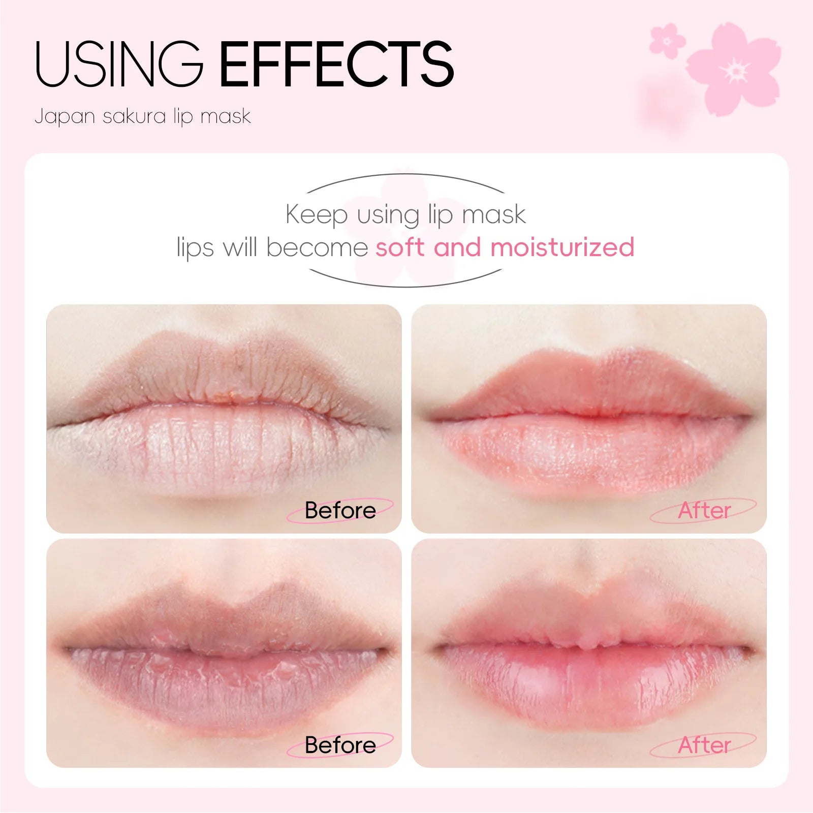 LAIKOU Lip Mask Moisturizing Hydrating Repair Lighten Lip Lines Labial Gel Patch Lips Pad Patches Lip Care Products 10/5PCS Oasis Select