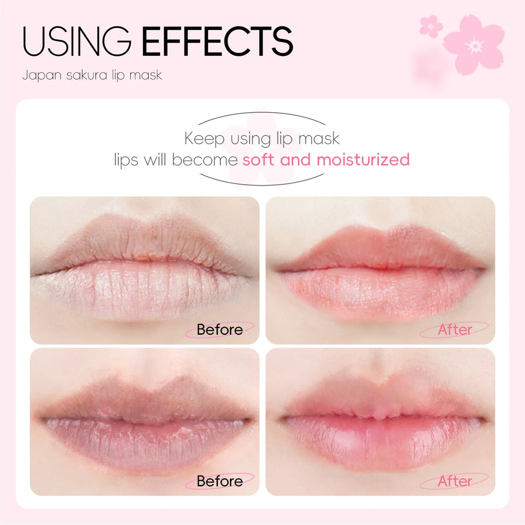 LAIKOU Lip Mask Moisturizing Hydrating Repair Lighten Lip Lines Labial Gel Patch Lips Pad Patches Lip Care Products 10/5PCS Oasis Select