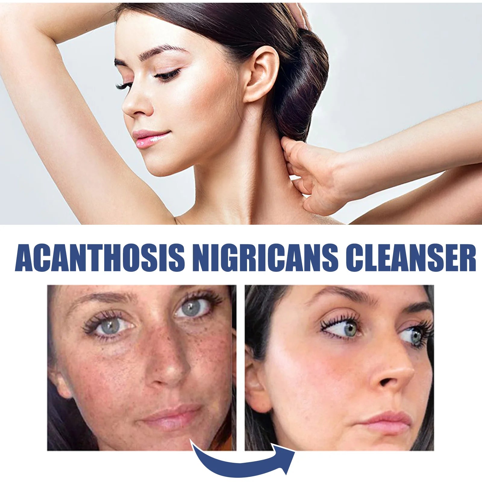 Brightening Facial Cleanser Remove Acne Dark Spots Melanin Oil Control Skin Cleansing Face Wash Blackhead Remover Face Cleaner Oasis Select