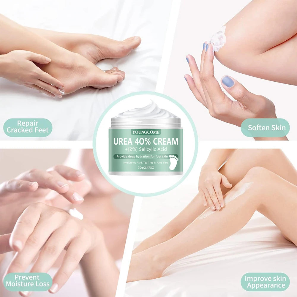 Urea 40% Foot & Hand Cream – Callus Softener | YOUNGCOME