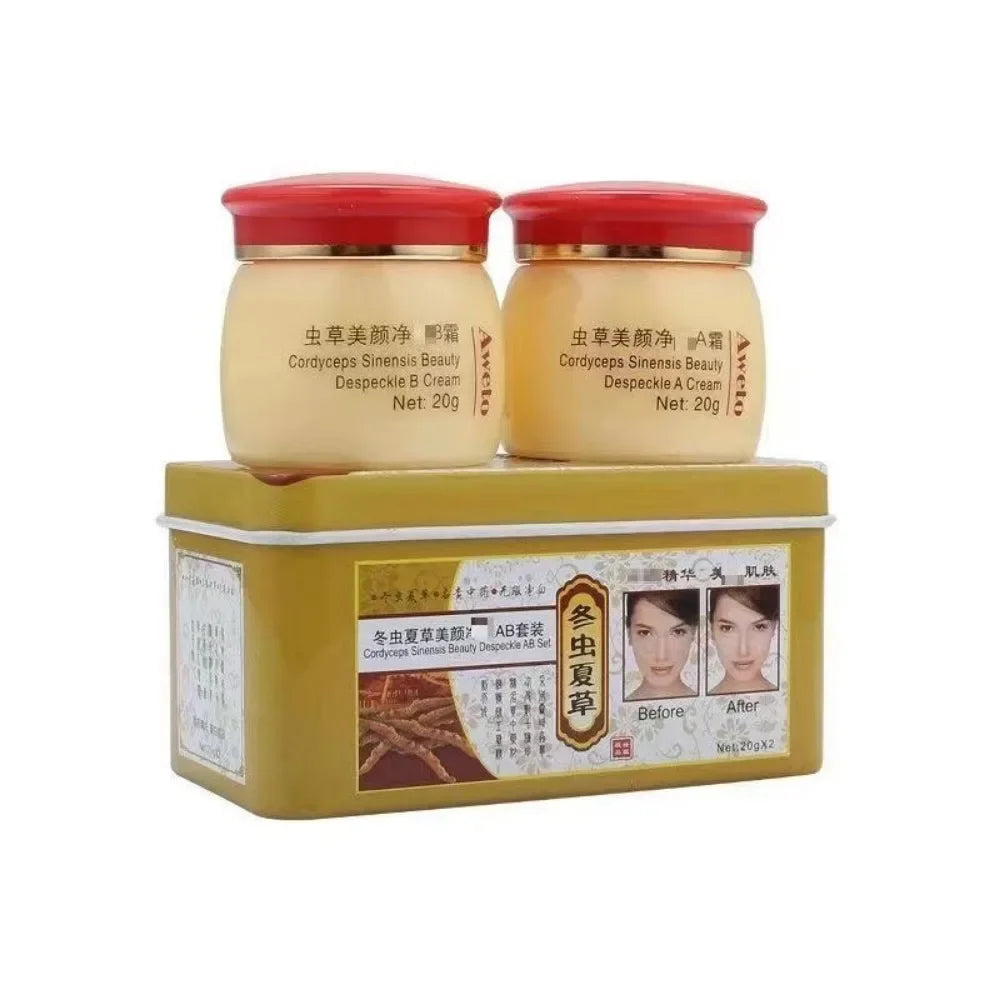 Original Chinese Aweto Whitening Anti-Acne Day Night Cream Set Melasma Dark Age Spots Freckle Remover Skin Lightening Skin Care Oasis Select DAY NIGHT CREAM