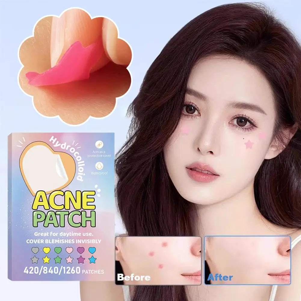 Colorful Star & Heart Acne Patches – 420 to 1260 Pcs Acne Patch Stickers Oasis Select