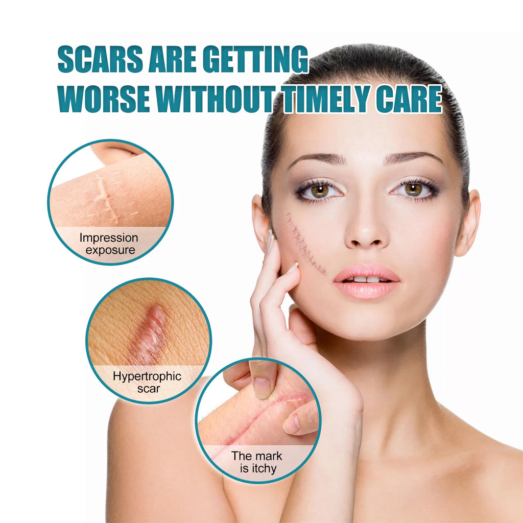Silicone Scar Sheets Roll 4cm×150cm | Self-Adhesive Scar Tape Silicone Scar Tape Oasis Select