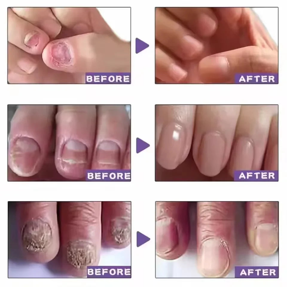 7 Days Nail Repair Serum | Plant Extract Nail Wellness Gel 10ml