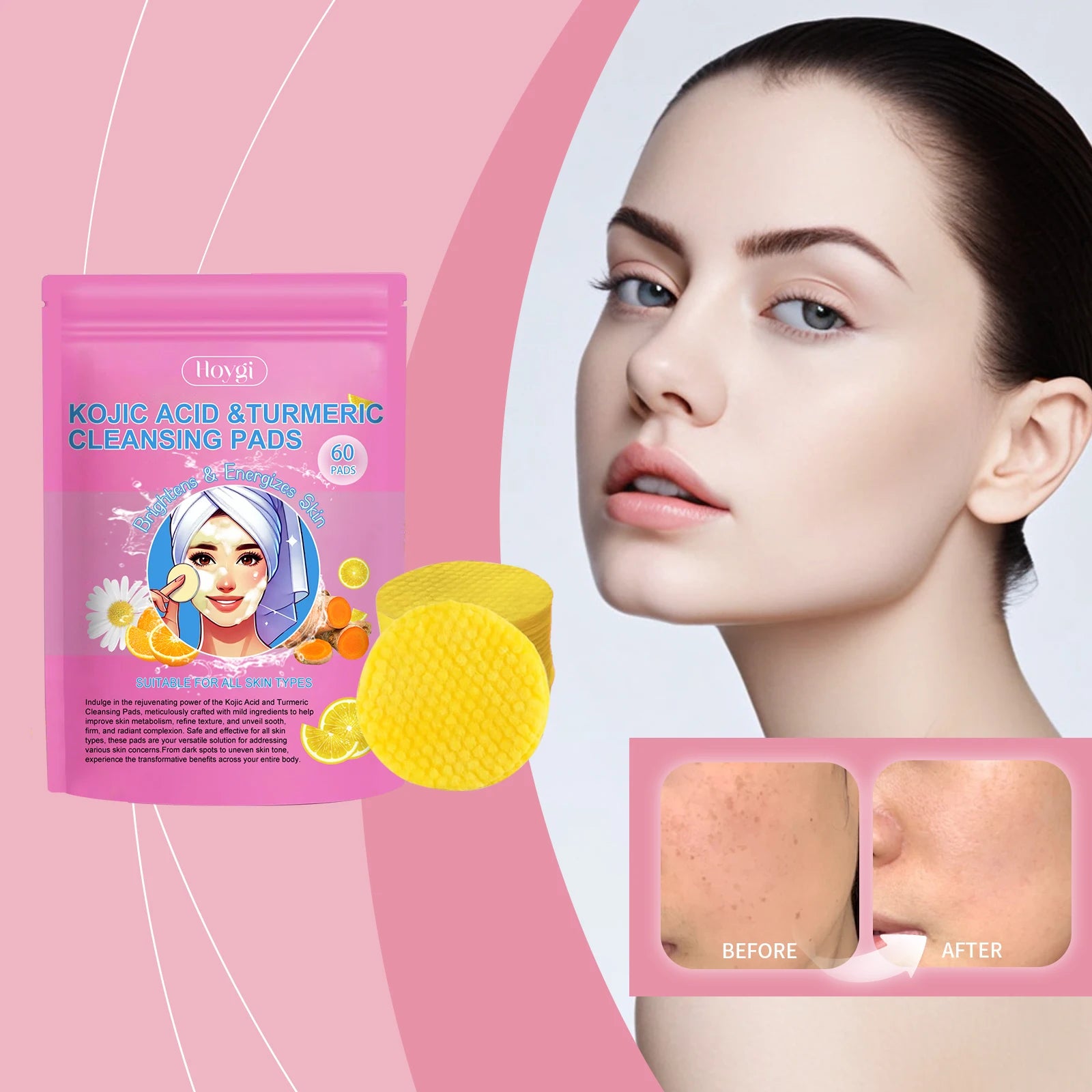 Turmeric & Kojic Acid Facial Cleanser Pads – Deep Pore Clean