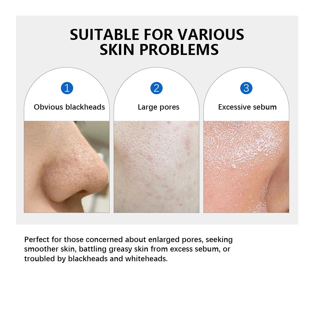 Lakerain 2Pcs Skincare Set 0‑Pore Toner Pad Pink Peptide Salmon DNA Glow Serum Pure Shea Butter Pore Care Moisturizer Oasis Select