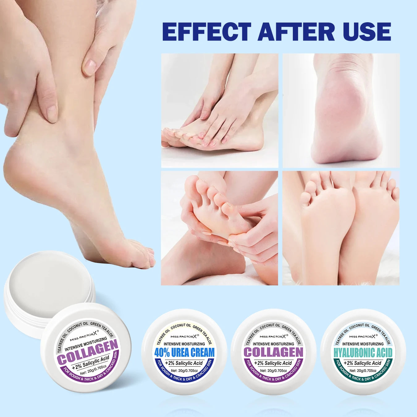 3PCS/Box Urea Foot Cream Moisturizer, with Salicylic Acid, for Dry and Cracked Feet - Hand and Foot Care for and Women Oasis Select