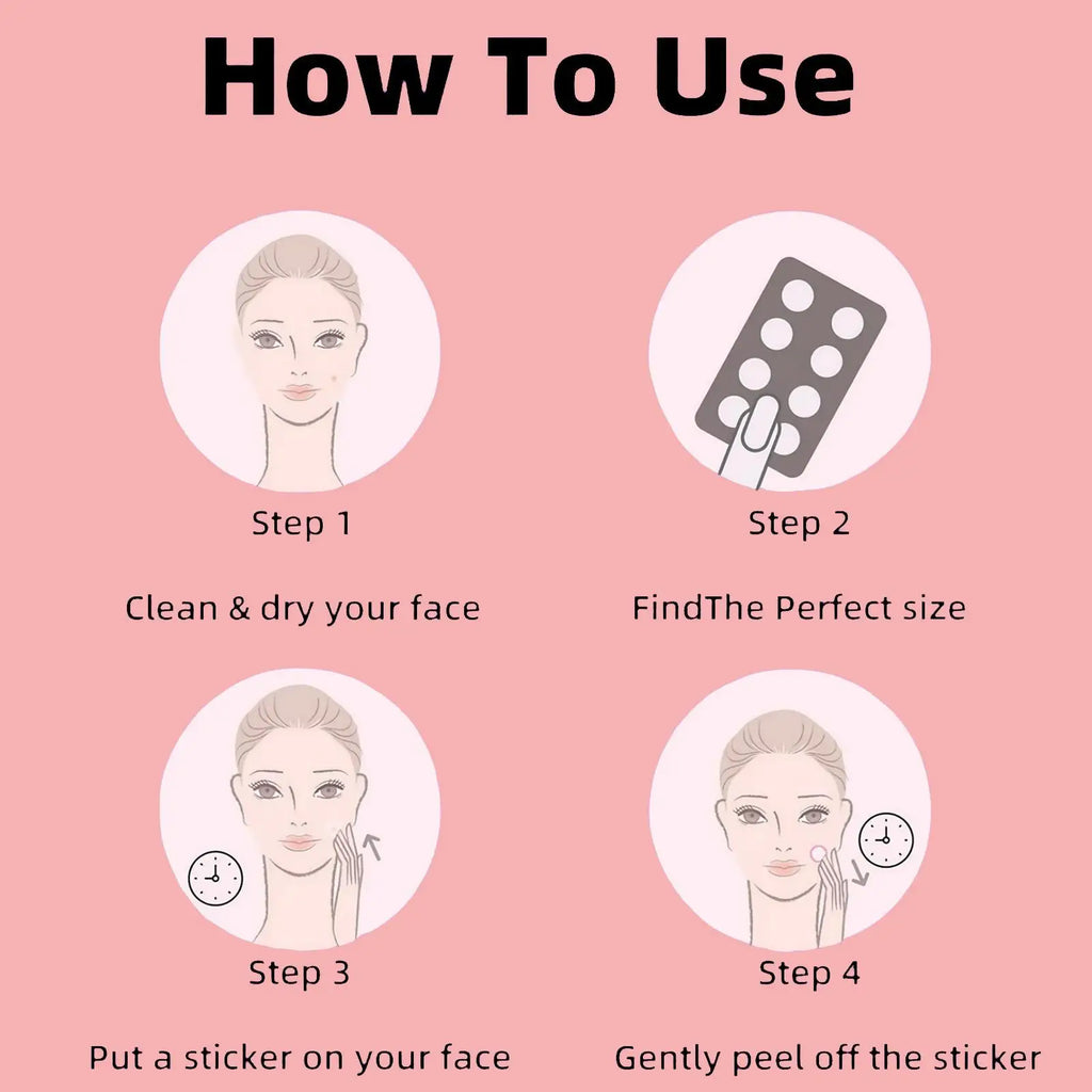 180/360/540/720pcs Hitworker Acne Patches, Hydrogel Cover, Cute Design, Suitable for All Light Skin Tones, Daily Use & Photo Pro Oasis Select