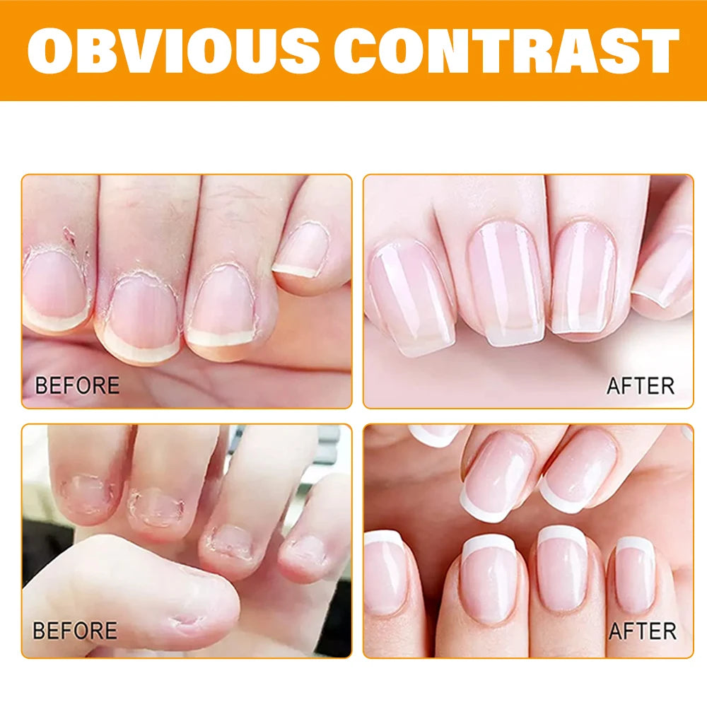Honey Nail Oil Cuticle Pen – Strengthener for Brittle Nails Nail Cuticle Oil Pen Oasis Select