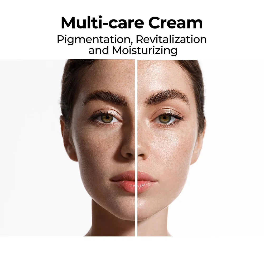 Eelhoe Skin Brightening Cream – Dark Spot Remover 20g Brightening Face Cream Oasis Select