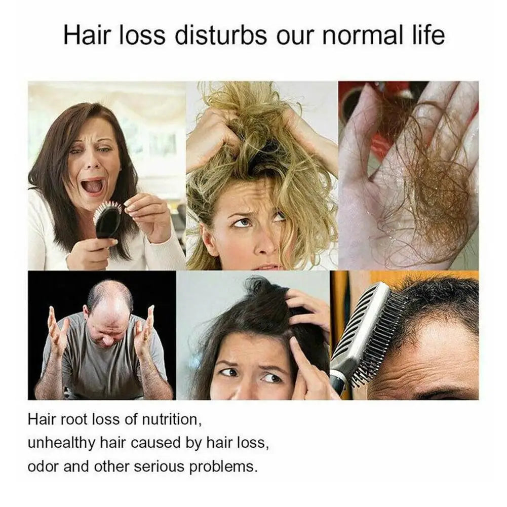 Ginger Hair Growth Shampoo Deep Cleaning Relieves Itching Stimulates Hair Follicles and Accelerates Hair Growth Shampoo Oasis Select