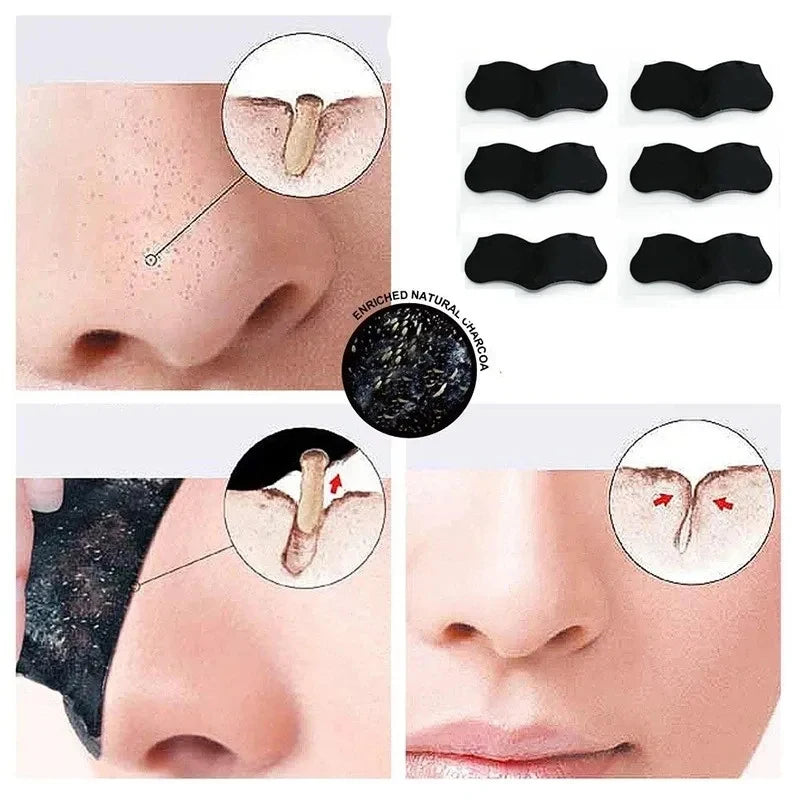 10/40/100pcs Unisex Blackhead Remove Mask Nasal Strips Shrink Cleansing Pore Nose Black Head Remove Sticker Skin Care Mask Patch Oasis Select