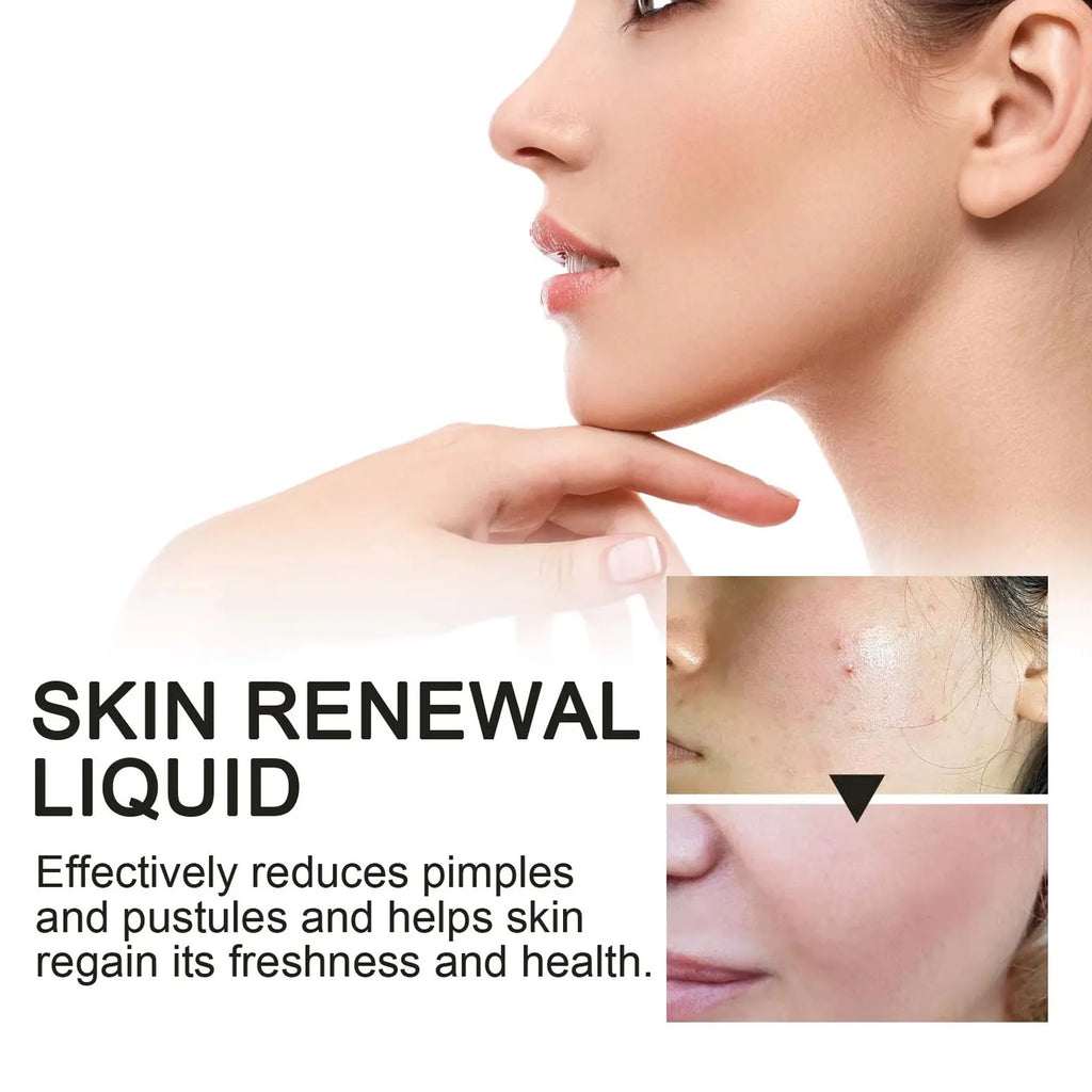 2% BHA Salicylic Acid Serum – Acne, Pores & Dark Spots | 118ml BHA Acne Serum Oasis Select