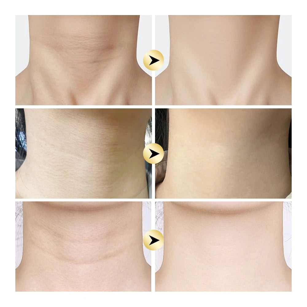 Firming Neck Cream with Acetyl Hexapeptide-8 | Moisturizing Firming Neck Cream Oasis Select