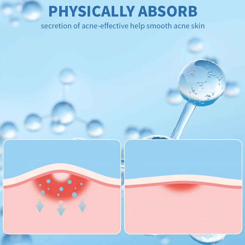400/800pcs acne patches, water-based gel non irritating, suitable for all skin types Oasis Select