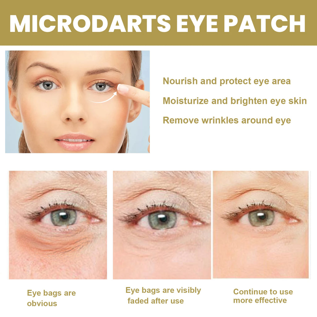 eelhoe Eye Patches – Moisturizing, Firming Under-Eye Mask