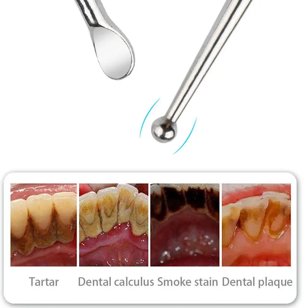 Steel Tonsil Stone Remover Tool – Reusable Oral Care Oral Care Tool Oasis Select