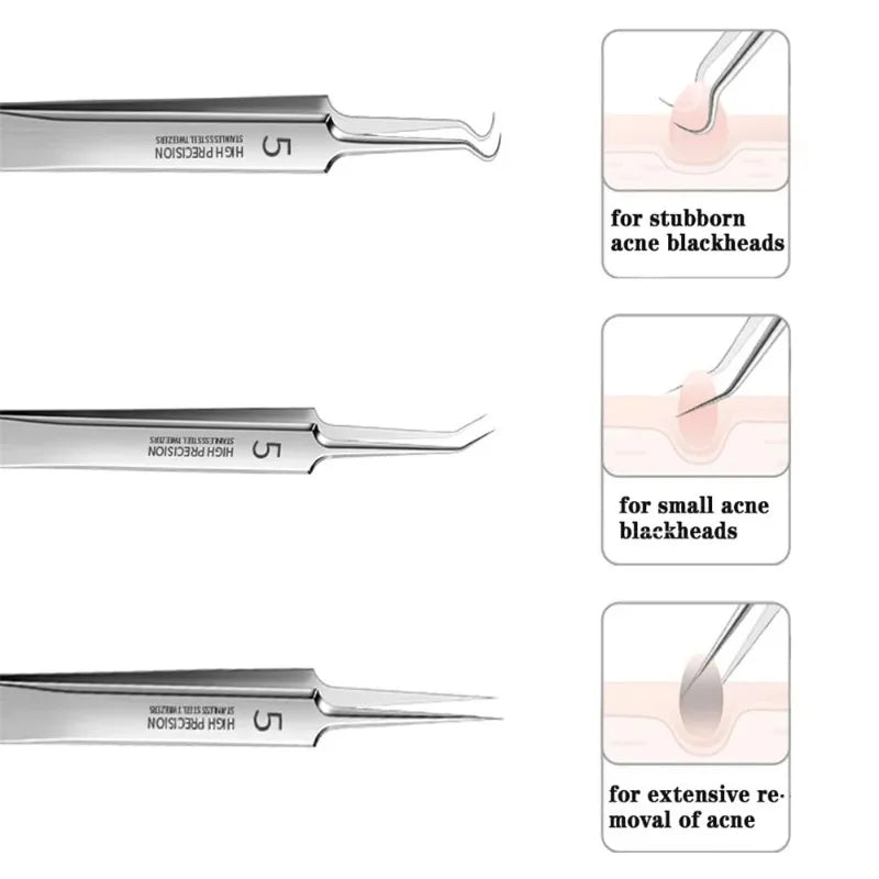 German Ultra-fine No. 5 Cell Pimples Blackhead Clip Tweezers Beauty Salon Special Scraping & Closing Artifact Acne Needle Tools Oasis Select