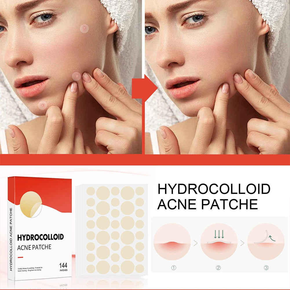 144pcs/set Face Skin Care Acne Pimple Patch 2 Sizes Invisible Professional Healing Absorbing Spot Sticker Covering for Men Women Oasis Select