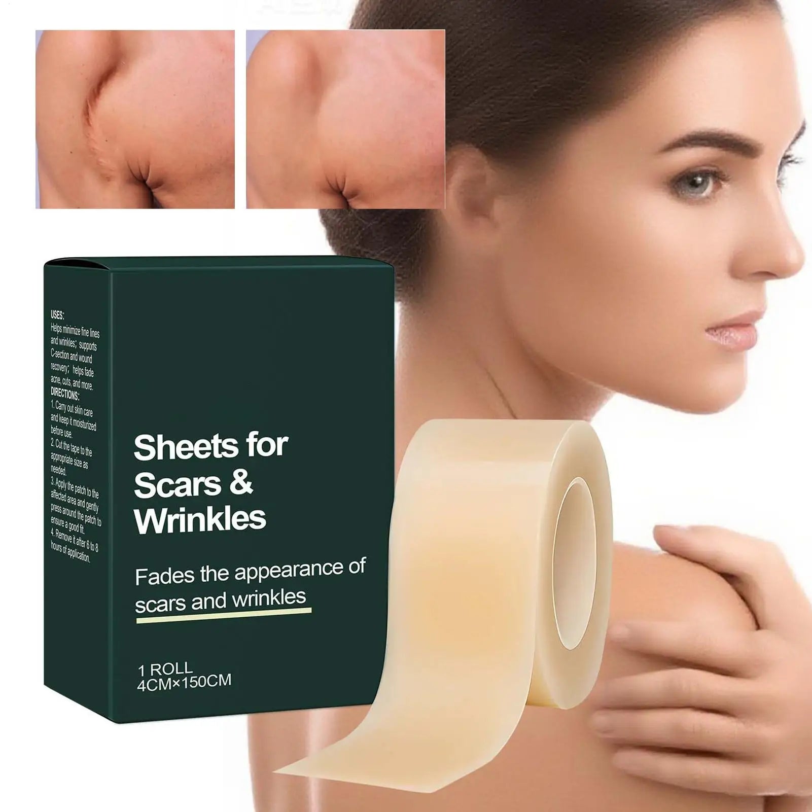 4cmx150cm 1Roll Silicone Scar Sheet Painless Scar Repair Tape Removal Strip For Surgery Burn Acne Roll Effective Scar Oasis Select