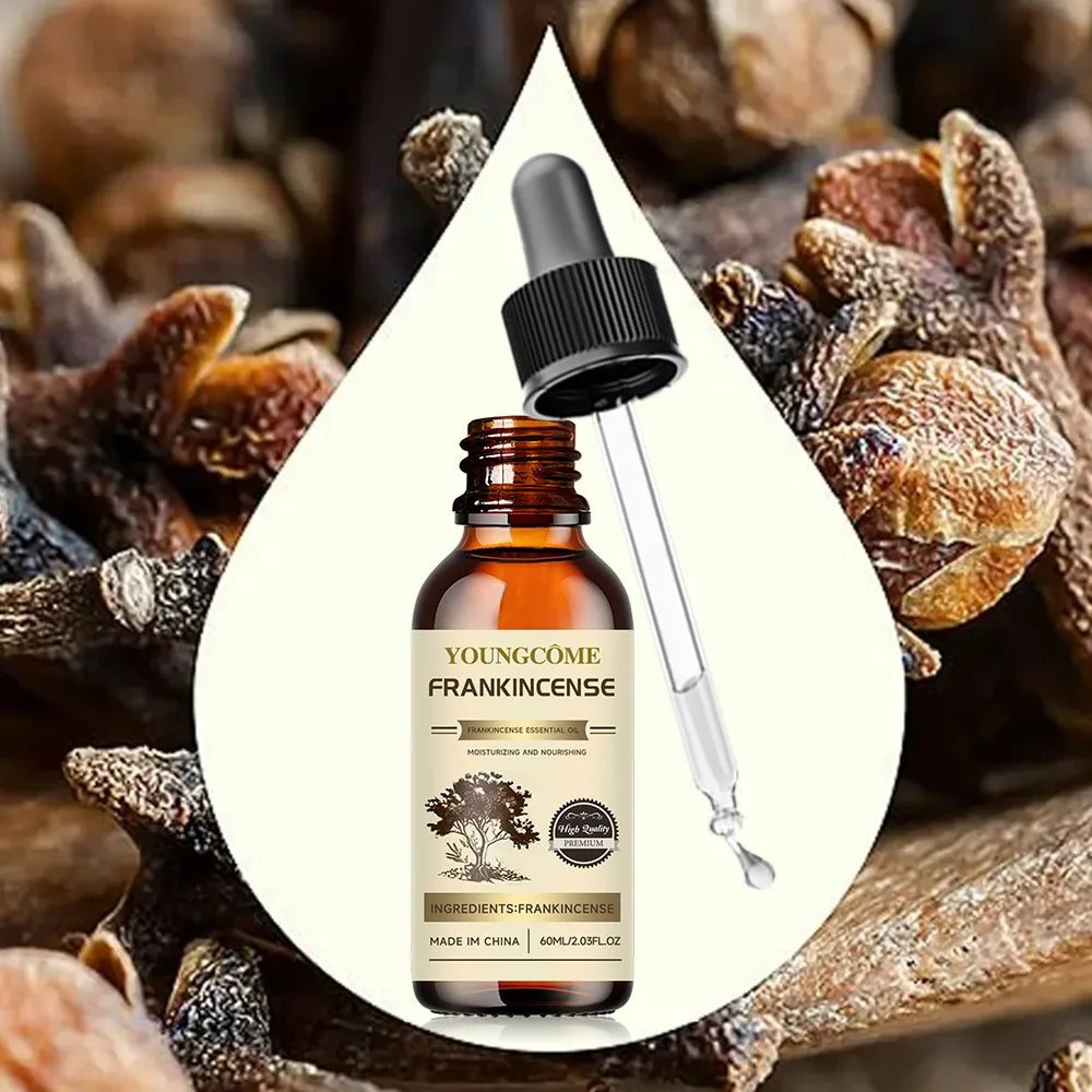 Frankincense Essential Oil – Face, Body & Hair Moisturizer