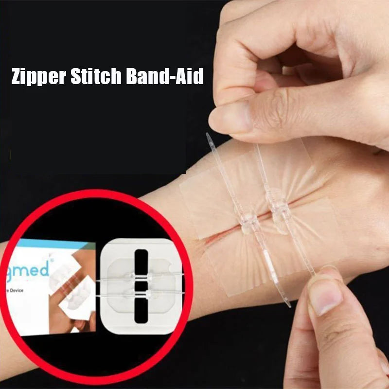 Emergency Wound Closure Zip Stitch Sutures Bandaids Repair Wounds Without Stitches For Outdoor Activities Quick Clot Wound Oasis Select